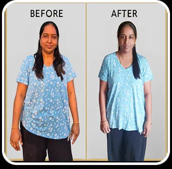 Member Transformation